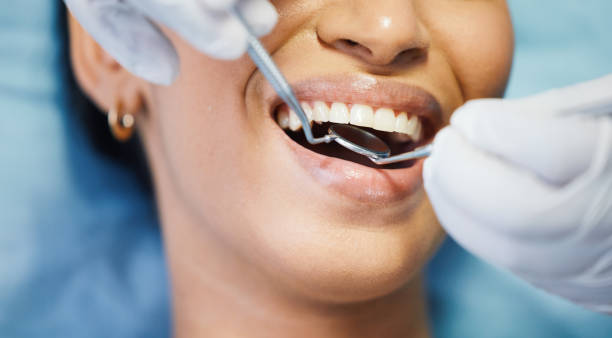 Best Dental Abscess Treatment in Clare, MI