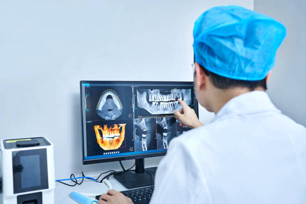 Best Dental Abscess Treatment in Clare, MI