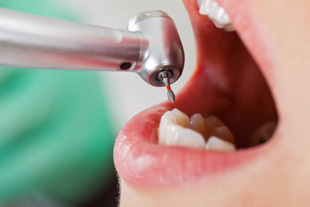 Best Emergency Care for Gum Disease in Clare, MI